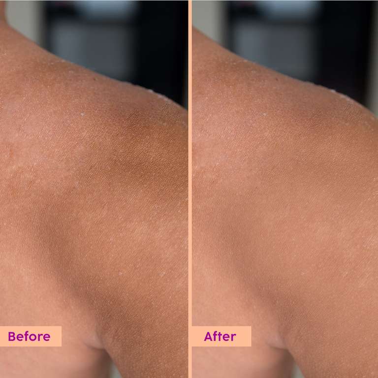 Plix Peaches & Lemon Detan Body Lotion with SPF 30 | Brightens & Moisturizes for Softer Skin, 150ml