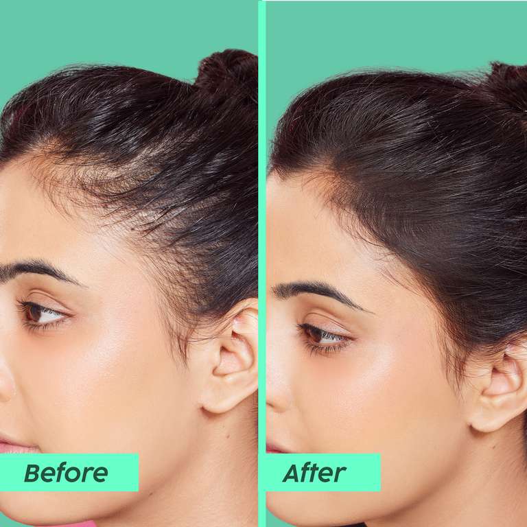 Plix Rosemary Anti-Hair Fall Advanced Conditioner for Soft, Smooth & Shiny Hair, 175ml